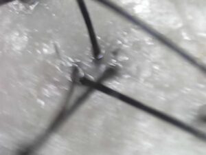 トップの分け目付近をマイクロスコープで撮影した頭皮画像